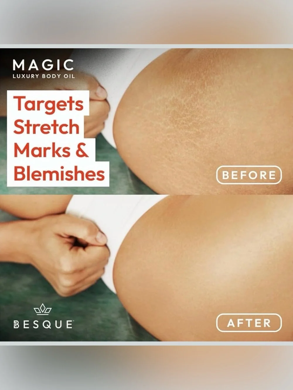 Besque Magic Luxury Body Oil — Nourishing Body Oil